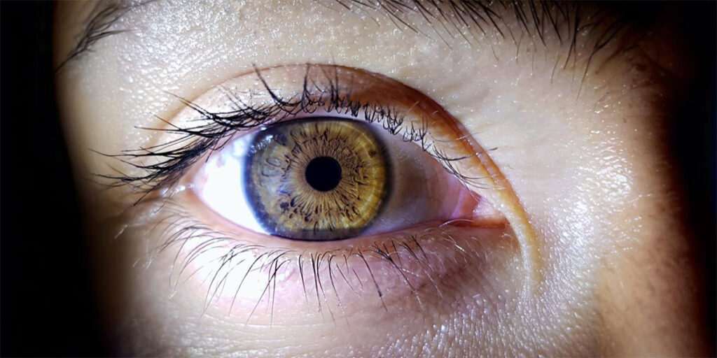 Green eyes